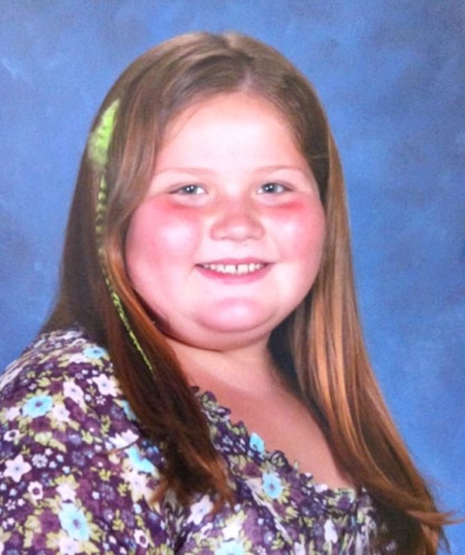 The Whole School Was Laughing At 9 Year Old Girl Because Of Her Weight Just Look At Her Now