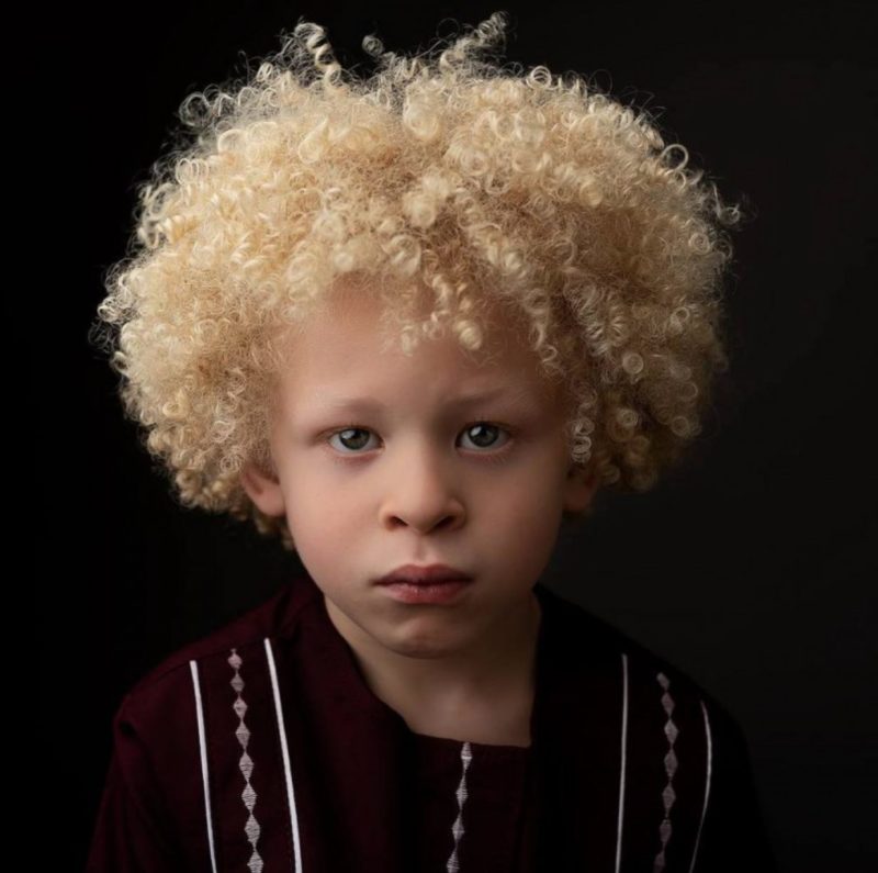 5-year-old аlbino boy has become a model after his mother posted a photo of him on Facebook