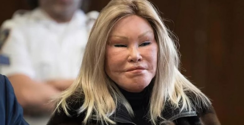 Catwoman of our times: what a woman with an unusual appearance looked like before plastic surgery