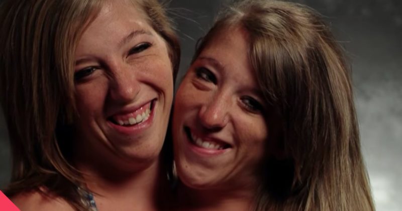 One life for two: what the most famous Siamese twins Brittany and Abigail look like now