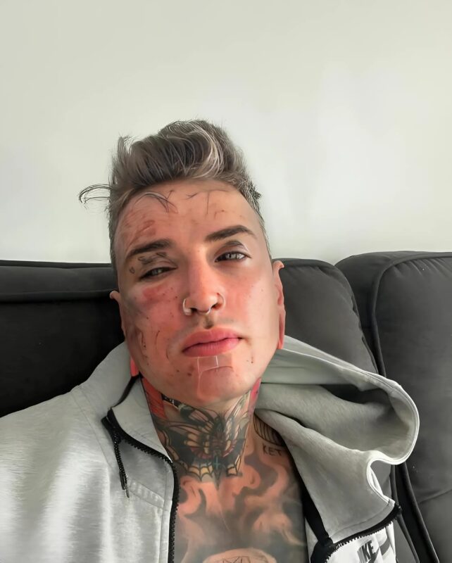 He removes his tattoos for his daughter: The heartbreaking transformation of a young father