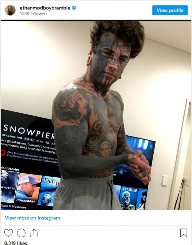 He removes his tattoos for his daughter: The heartbreaking transformation of a young father