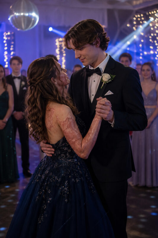 A boy invited me to dance at prom even though no one else wanted to because of the scars on my face — the next morning, his parents showed up at my house with the police...