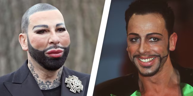 The man often described as Germany’s most handsome man didn’t always look this way: His old photos have left many people stunned