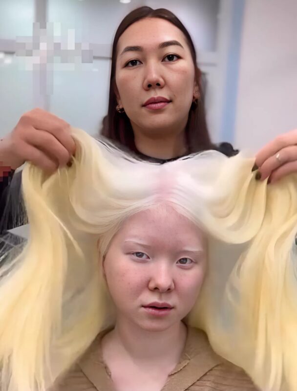For 18 years, she was bullied because of her white hair… Then she dyed it black, and the transformation stunned everyone