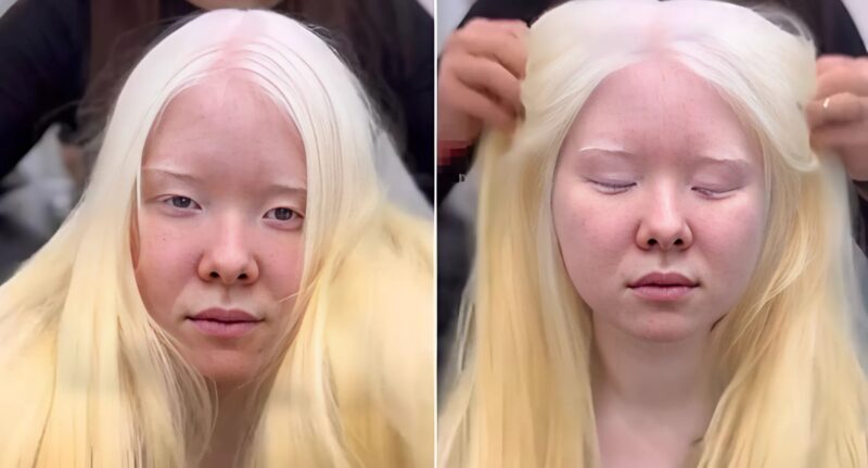 For 18 years, she was bullied because of her white hair… Then she dyed it black, and the transformation stunned everyone