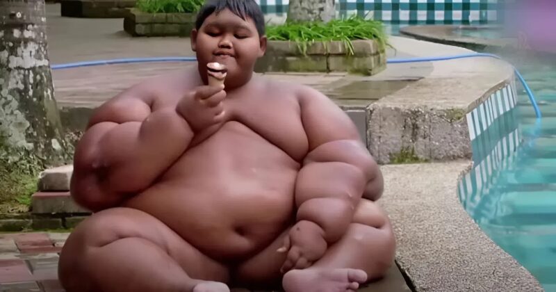 At 10 years old, this boy weighed nearly 191 kg and was considered the heaviest child in the world: today he has slimmed down and weighs only 85 kg