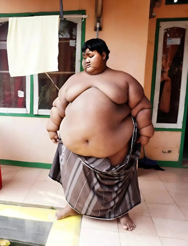 At 10 years old, this boy weighed nearly 191 kg and was considered the heaviest child in the world: today he has slimmed down and weighs only 85 kg