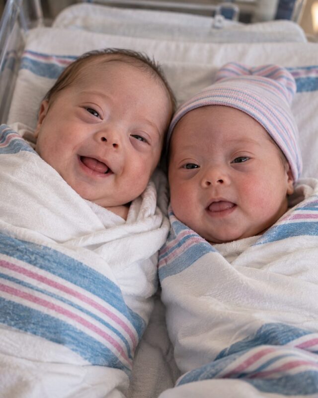 Both of my newborn babies had Down syndrome, so I left them at the hospital. But before I could reach my car, a nurse came running after me, screaming, “WAIT! What they told you about your babies isn’t the whole truth!”